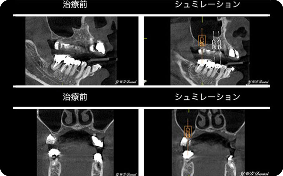 シミュレーションシステム「ガイデッドサージェリー」について